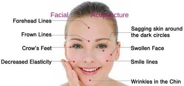 Facial Acupuncture NYC 