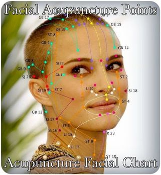palsy acupuncture bell nyc facial bells paralysis treatments paralyzed muscles