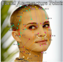 New York City Facial acupuncture 